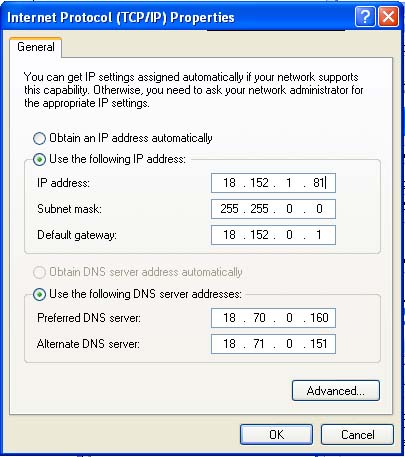 Setting IP and DNS Addresses